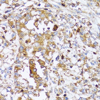 Polyclonal Rabbit anti-Human ACTR2 / ARP2 Antibody (IHC, IF, WB)