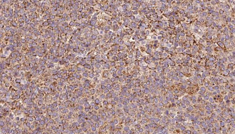 Polyclonal Rabbit anti-Human ARHGDIB / D4 GDI Antibody (IHC, IF, WB)