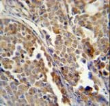 ALDH3A2 Antibody
