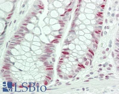 IHC-plus™ POLR2A / RNA polymerase II Antibody (C-Terminus)