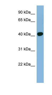 RING1 Antibody (aa215-264)
