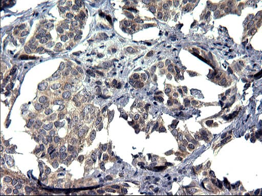 TXNDC5 / ERP46 Antibody (clone OTI1C3)