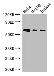 HPSE / Heparanase Antibody