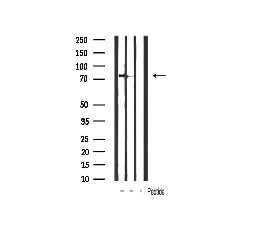 CHUK / IKKA / IKK Alpha Antibody (phospho-Ser176,pSer177)