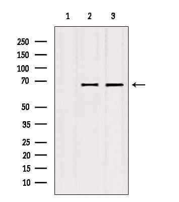 Polyclonal Rabbit anti-Human ATP6V1A1 / ATP6V1A Antibody (IHC, WB)