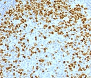 Monoclonal Mouse anti-Human TOP2A / Topoisomerase II Alpha Antibody (clone TPM2A-2, Azide-free,BSA-free, IHC, IF, WB)