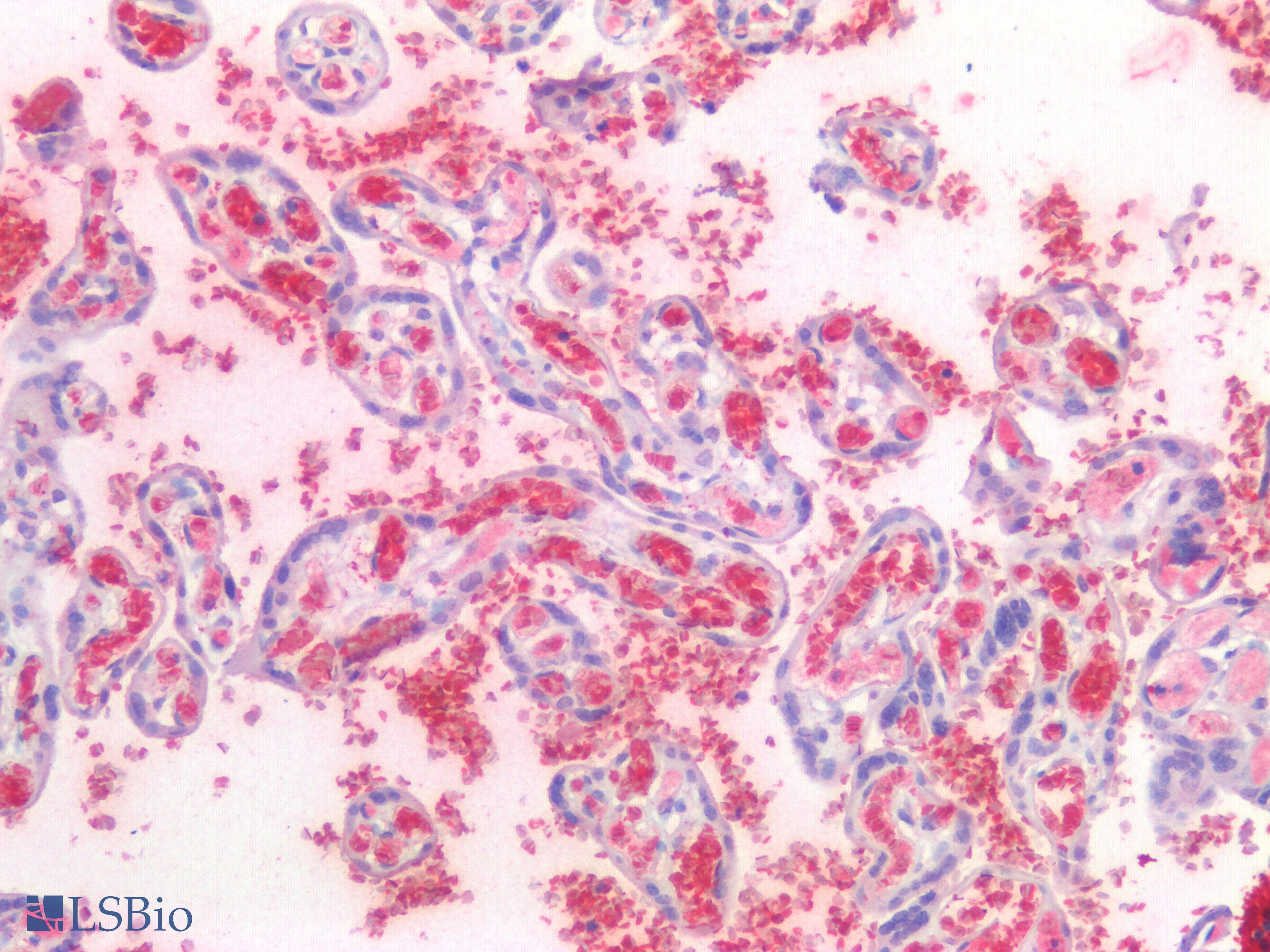 PathPlus™ HBA2 / Hemoglobin Alpha 2 Antibody