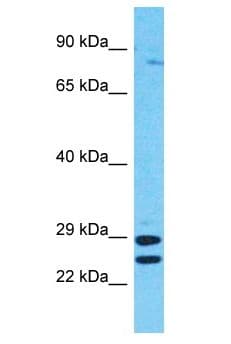 RSHL1 Antibody (aa538-587)