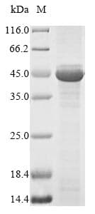 Human HAPLN1 Protein (Recombinant 10His, N-terminus)