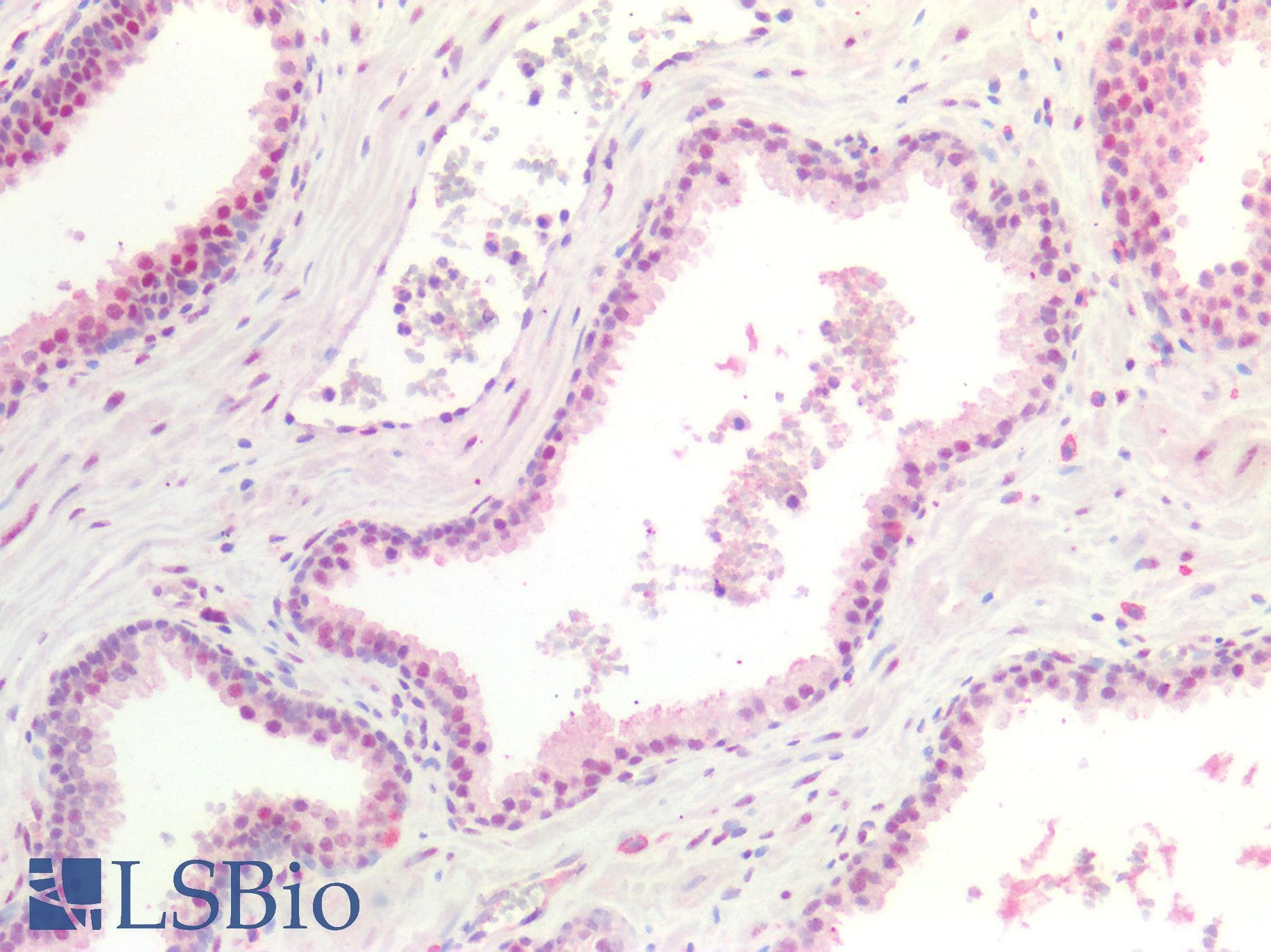 PathPlus™ SMAD3 Antibody
