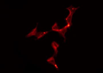 Polyclonal Rabbit anti-Human HTR1B / 5-HT1B Receptor Antibody (IF, WB)
