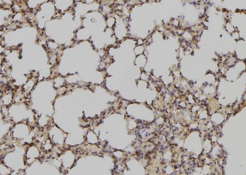 ATXN7L3 Antibody