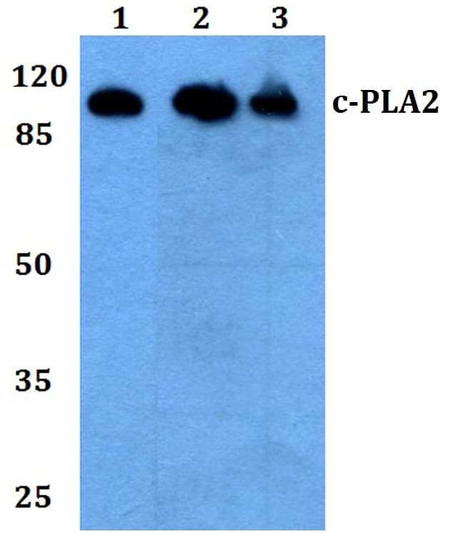 IHC-plus™ PLA2G4A Antibody (aa480-530)