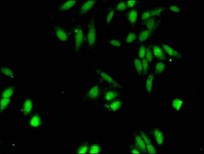 Polyclonal Rabbit anti-Human HIST1H2AI Antibody (IF, WB)