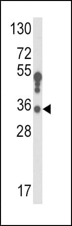HSD17B3 Antibody (aa89-118)