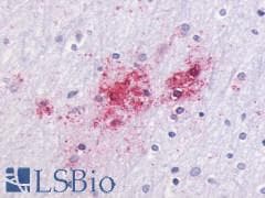 PathPlus™ Polyclonal Rabbit anti-Human GPR87 Antibody (C-Terminus, IHC)