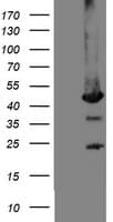 Mannose Phosphate Isomerase Antibody (clone OTI4A11, Carrier-free)