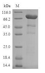 Human AIPL1 Protein (Recombinant GST, N-terminus)