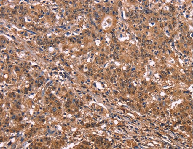 NOS2 / iNOS Antibody