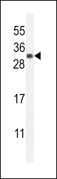 Polyclonal Rabbit anti-Human FGF9 Antibody (aa31-58, WB)