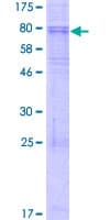 Human KCNJ1 / ROMK Protein (Recombinant GST)