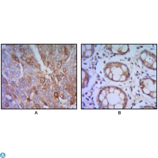 Monoclonal Mouse anti-Human HHIP / HIP Antibody (IHC, IF, WB)