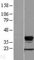 HOXD8 Protein (Over-Expression Lysate Myc-DDK (Flag))