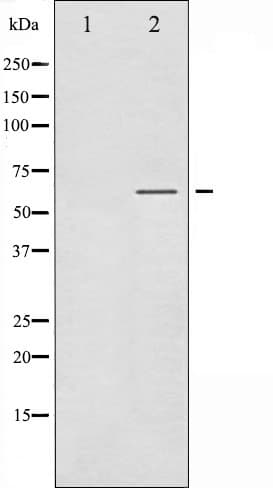 SGK1 / SGK Antibody (phospho-Ser422)