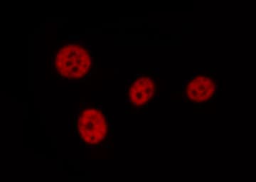 LIG1 / DNA Ligase 1 Antibody