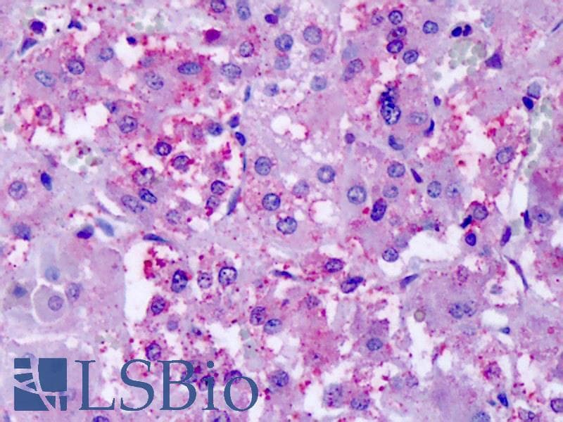 IHC-plus™ CHRM2 / M2 Antibody (Cytoplasmic Domain)