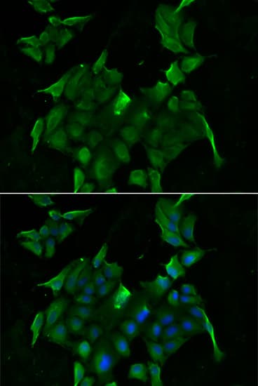 IHC-plus™ SLC34A1 / NPT2 Antibody