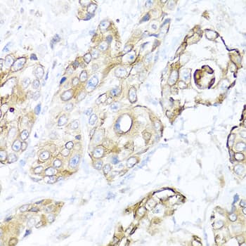 NRG4 Antibody