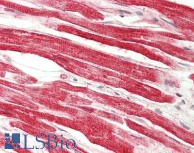 IHC-plus™ IFNAR2 Antibody