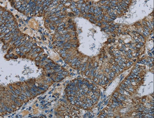 NDUFA5 Antibody