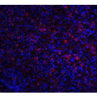 ABCA1 Antibody