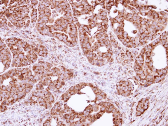 Polyclonal Rabbit anti-Human FIS1 Antibody (aa1-152, IHC, WB)