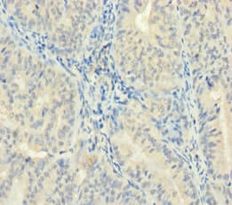Polyclonal Rabbit anti-Human ZMAT5 Antibody (aa1-170)