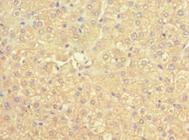 Polyclonal Rabbit anti-Human SCAD / ACADS Antibody (aa1-260, IHC, WB)