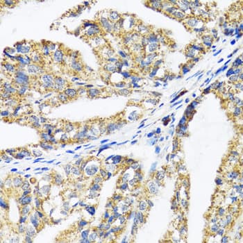 IHC-plus™ Band 4.1 / EPB41 Antibody