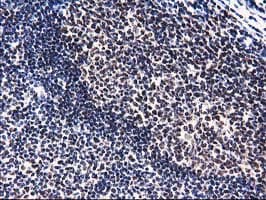 PYCRL Antibody (clone OTI8H6)