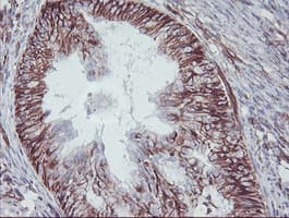 KIF2C / MCAK Antibody (clone OTI1C5)
