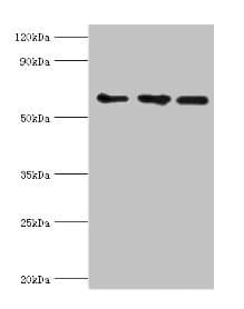Polyclonal Rabbit anti-Human ABCE1 Antibody (aa320-599, IHC, WB)