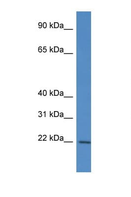 Polyclonal Rabbit anti-Human RPL12 / Ribosomal Protein L12 Antibody (aa24-73, WB)