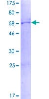 Human SDCBP2 / Syntenin 2 Protein (Recombinant GST)