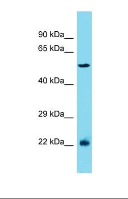 MRPL2 Antibody (aa97-146)