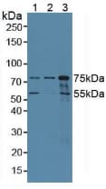 COIL / Coilin Antibody (aa319-538)