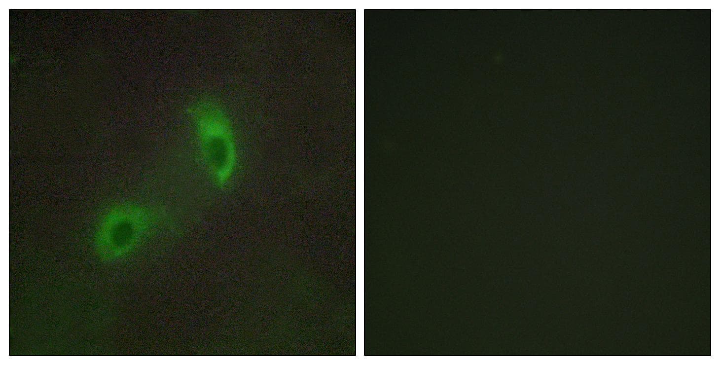 Polyclonal Rabbit anti-Human HRS / HGS Antibody (IHC, IF, WB)