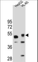 TIGD3 Antibody (aa378-407)