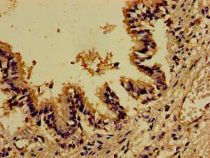 DOCK180 / DOCK1 Antibody