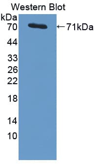 PSMD4 / RPN10 Antibody (aa1-377)